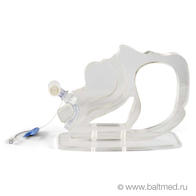 Тепловлагообменник AEROvent® для трубки трахеостомической («искусственный нос») - HB-F01-KNTS, HBF01-KNTT